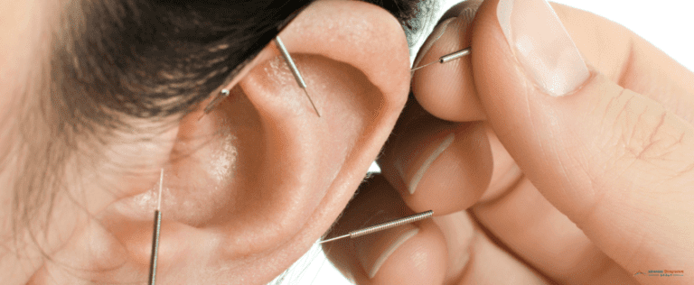 ACG-ear acupuncture